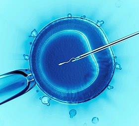 Intracytoplasmic injection is&nbsp;the most commonly used IVF technique. A&nbsp;single sperm cell is&nbsp;injected directly into the cytoplasm of&nbsp;an&nbsp;egg. Wikimedia commons